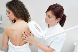 Dermatologa examinando lunares