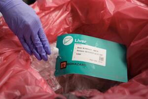 Organ Donation Diversity