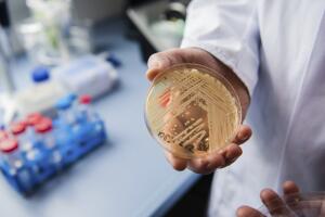 Experts warn of newly-discovered yeast
