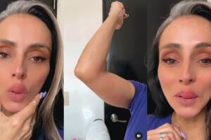 Ivonne Montero también mostró la picadura que sufrió en uno de sus brazos.