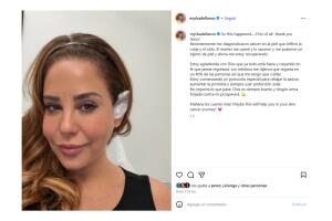 Así dio a conocer Myrka Dellanos su diagnóstico de cáncer de piel.