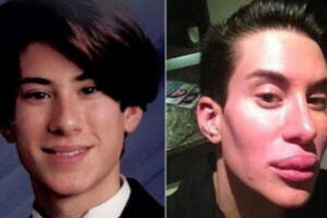  Justin Jedlica