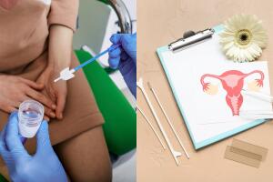 qué hacer antes del papanicolau