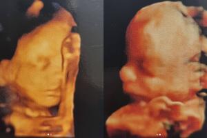 A la izquierda aparece el bebé varón de Claudia Álvarez y a la izquierda se muestra a la niña.