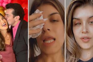 Hija mayor de Jorge Salinas, Gabriella, muestra resultado de la operación que se hizo en el rostro