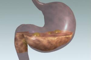 pilula-do-paozinho-3.jpg