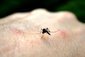 zika-virus-em-bebes-2.jpg