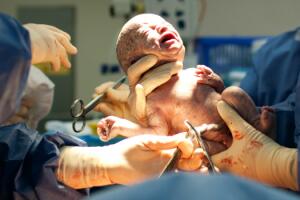 cesarea-e-parto-normal-2.jpg