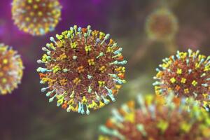 Hendra virus infection