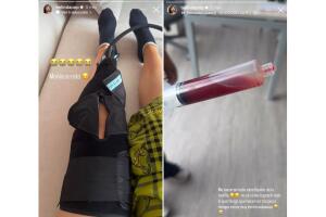 Belinda sufrió un desgarre del fibrocartílago de la rodilla, informó en Instagram.