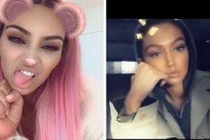 Cirugía plástica en la cara para verte como filtro de Snapchat