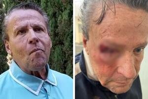 Alfredo Adame dice que podría tener "desprendimiento de retina" tras ser golpeado