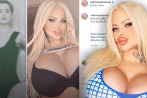 Sabrina Sabrok presume labios gigantes que le costaron 3 mil dólares, pero "ya no puede reír": suma más de 50 cirugías