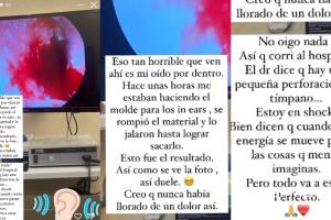 Anahí reveló que el diagnóstico que recibió es que sufrió un "pequeño rompimiento de tímpano". 