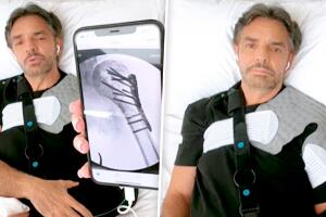 Accidente de Eugenio Derbez: se deja ver tras una de sus fisioterapias