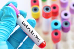 Identifican 50 edificios con Legionella en Manhattan; brote suma 84 casos.