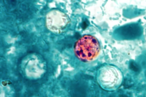 Cyclospora