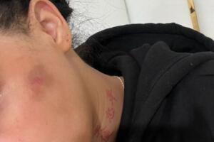 Yailin muestra los presuntos golpes de Anuel