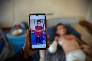Child-Hurt-In-Rafah-Attack-In-Gaza