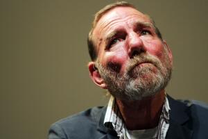 Pete Postlethwaite