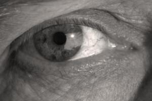pq_os_olhos_ficam_amarelos.jpg