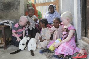 albinos-en-africa.jpg