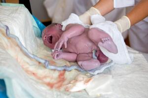 bebe_recien_nacido_con_cordon_umbilical.jpg