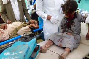 Decenas de muertos y heridos por bombardeo contra un bus con niños en Yemen