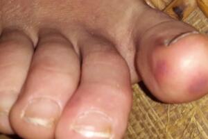 Nuevos síntomas 8.jpg