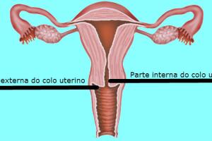 duvidas-ginecologista-1_0.jpg