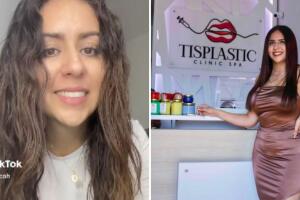 Alejandra Tiscareño organiza tandas para cirugías plásticas