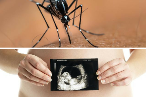 El virus del Zika en las embarazadas