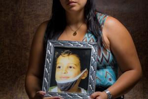 Niños con leucemia en Venezuela