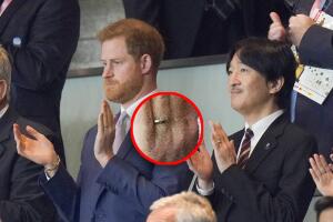 HARRY-ANILLO.jpg