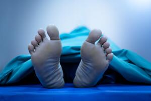 Dead Body's Feet Covered with Sheet without Tag on the Table