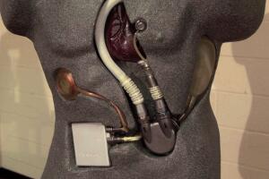 salud marcapasos enfermedades