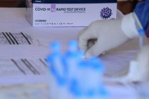 Covid en Liga MX