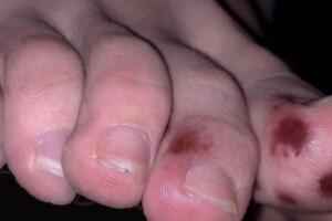 Nuevos síntomas 11.jpg