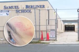  Madre denuncia que su hijo autista de 3 años regresó con lesiones de escuela en Newark