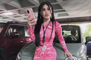 Así luce Gomita tras su última cirugía.