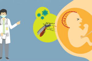 zika-cirus-causa-microcefalia.jpg