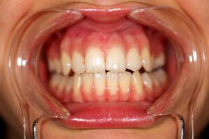 Dientes