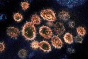 CORONAVIRUS-NOVAVAX-VACUNA