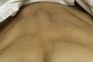 gravida-sarada-barriga.jpg
