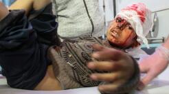 "Un baño de sangre": cerca de 200 civiles mueren en Siria por los bombardeos del régimen en una zona de oposición