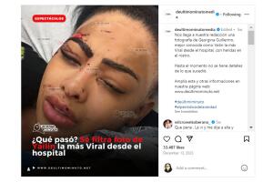 Yailin en el hospital