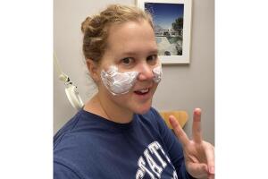 amyschumer_rellenos-faciales-instagram.jpg
