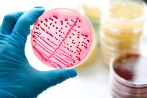 Casos de "supergonorreia" foram identificados nos EUA pela 1ª vez