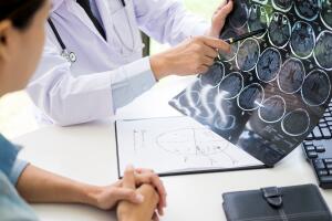 doctor analyzing a scan or x-ray film or explains a CT scan thoughtful expressions method talking to patient treatment on brain to an anomaly.