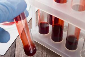 exame-de-sangue_0.jpg